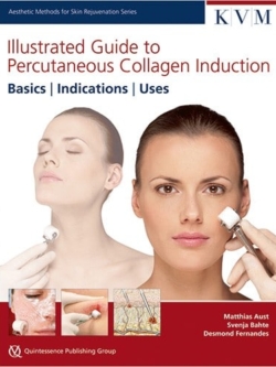 30134 Cover IG Percutaneous Collagen Induction