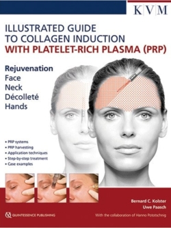 30253 Cover Illustrated Guide to Collagen Induction with PRP