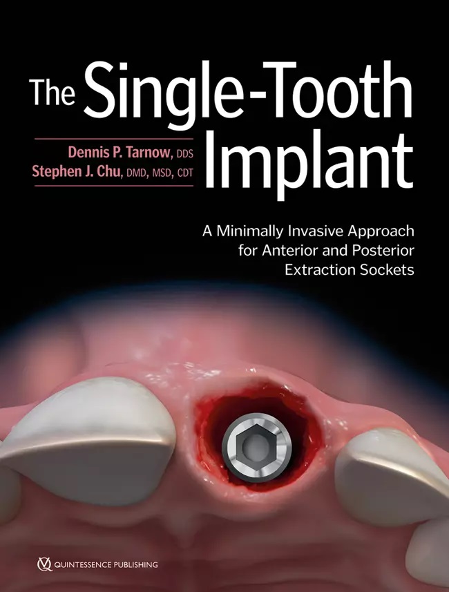 22831 cover tarnow single tooth implant