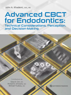 advanced cbct for endodontics