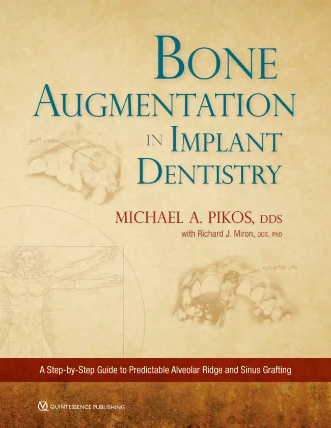 bone augmentation in implant dentistry