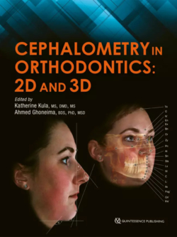 cephalometry in orthodontics