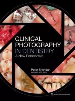 clinical photography in dentistry