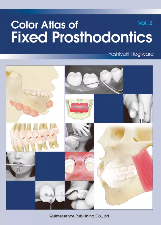 color atlas of fixed prosthodontics volume 2