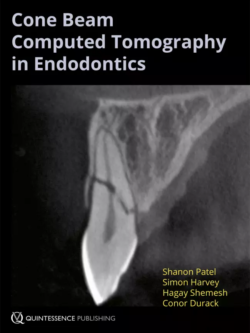 cone beam computed tomography in endodontics