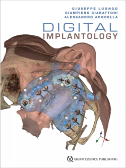 digital implantology