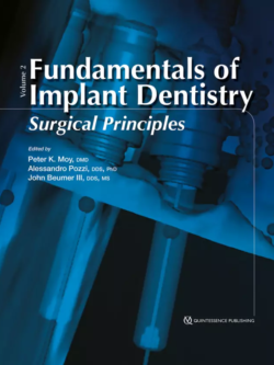 fundamentals of implant dentistry volume 2