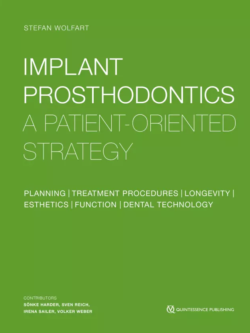 implant prosthodontics 1