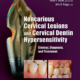 noncarious cervical lesions and cervical dentin hypersensitivity
