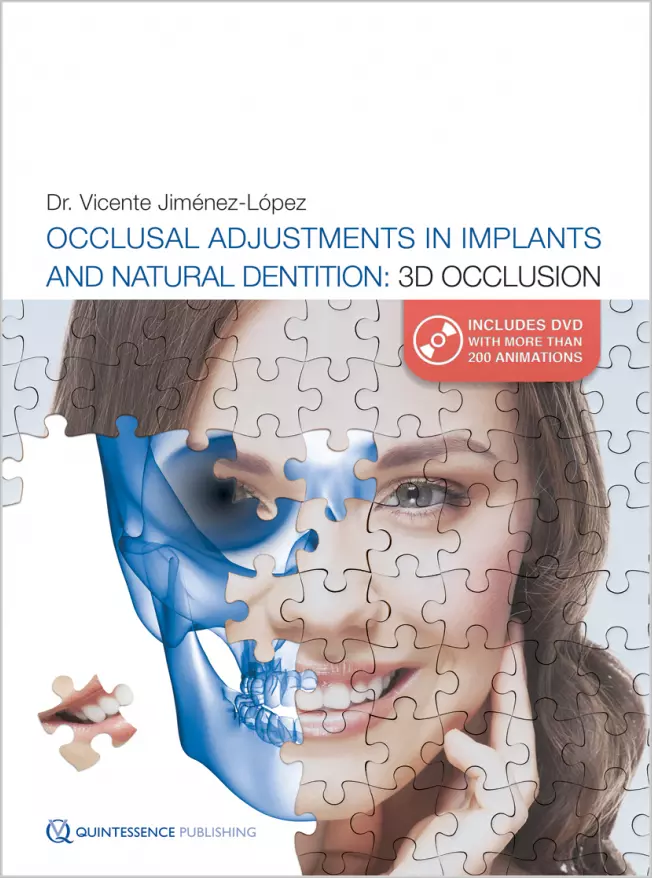occlusal adjustments in implants and natural dentition 3d occlusion