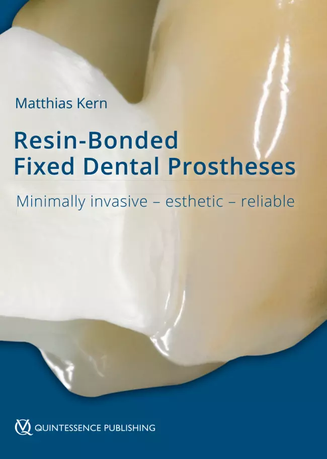 resin‑bonded fixed dental prostheses