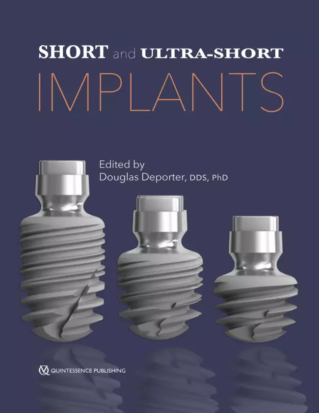 short and ultra‑short implants