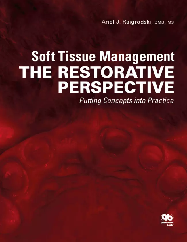soft tissue management