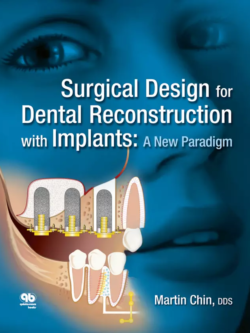 surgical design for dental reconstruction with implants