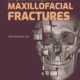 surgical management of maxillofacial fractures