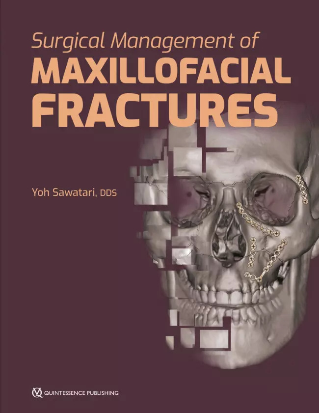 surgical management of maxillofacial fractures