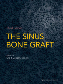 the sinus bone graft