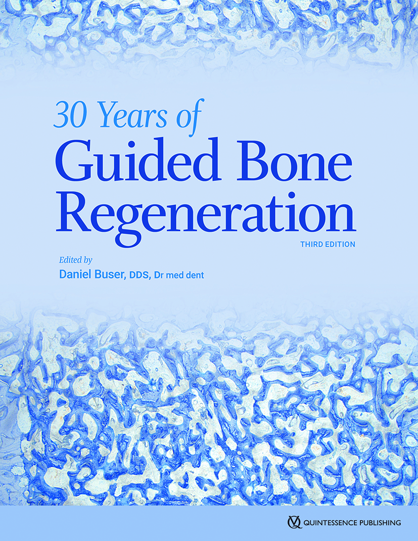 23171 cover buser 30 years of guided bone regeneration