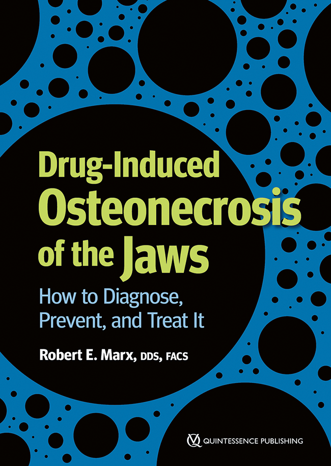 23861 cover marx drug induced osteonecrosis of the jaws 650pix