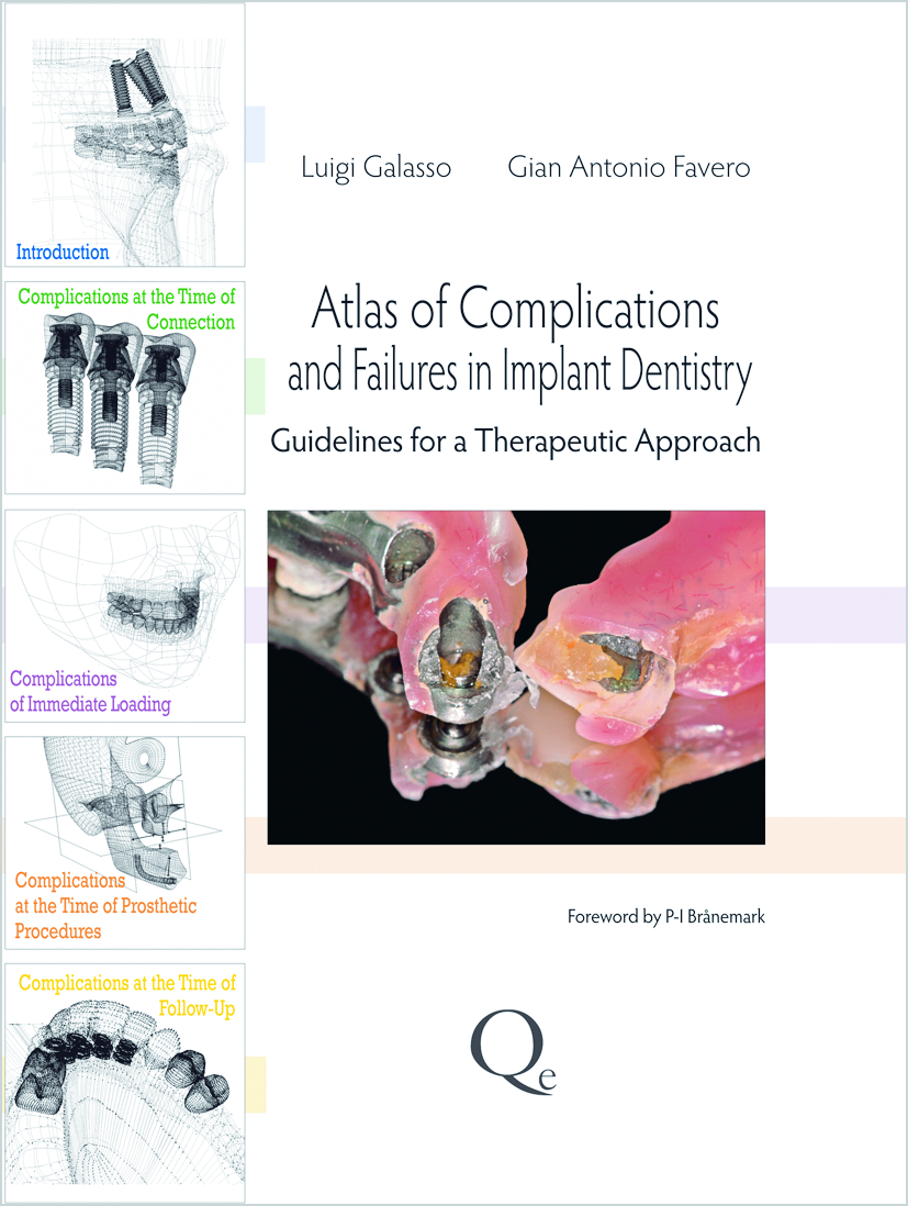 15121 cover galasso atlas of complications and failures in implant dentistry