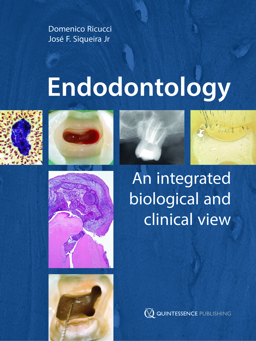 19691 cover ricucci endodontology