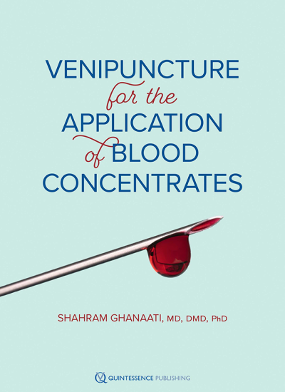 cover ghanaati venipuncture for the application of blood concentrates 650pix@2x.3e6fe1f8
