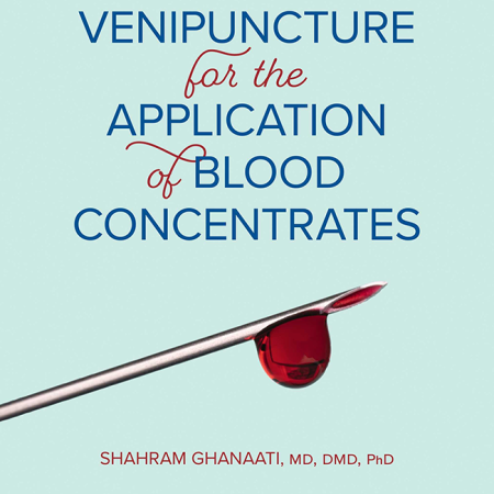 cover ghanaati venipuncture for the application of blood concentrates 650pix@2x.3e6fe1f8