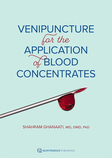 cover ghanaati venipuncture for the application of blood concentrates 650pix@2x.3e6fe1f8