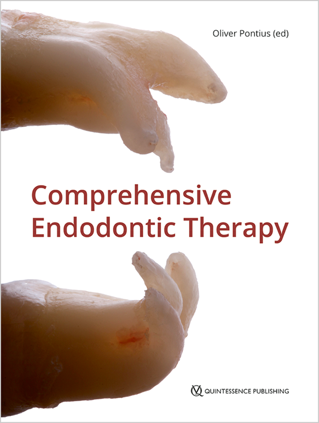 cover pontius comprehensive endodontic therapy@2x 1.6bcd8c1c cover pontius comprehensive endodontic therapy@2x 1.6bcd8c1c