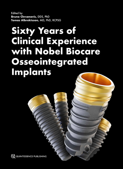 cover albrektsson sixty years clinical experience nobelbiocare implants 650pix@2x.9fbb2e94