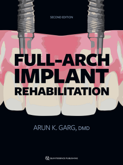 cover garg full arch implant rehabilitation 2nd ed 650pix@2x.abed915f
