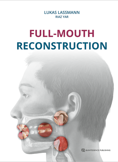 cover lassmann full mouth reconstruction 650pix 391048@2x.5de6d886